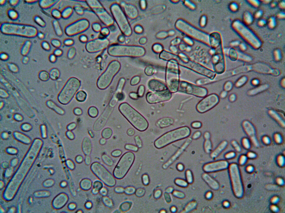 강아지 진드기 매개 감염병의 원인균들
